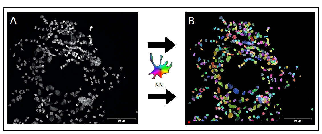 Ansammlung von Immunzellen